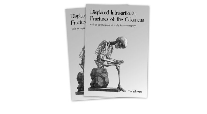 Proefschrift Tim Schepers